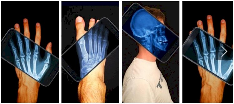 8 Best Apps To See Through Clothes For Android/iOS (2023) 8 xray body scanner simulator